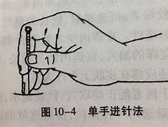 那手我下针全文免费阅读_那手我下针免费阅读无名小说网